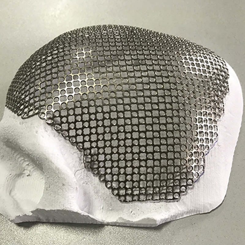 Metal Skull Laser Cutting Machine
