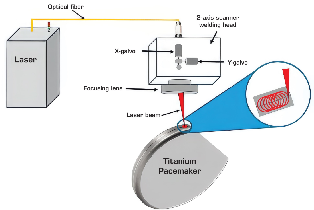 pacemaker laser welding equipment